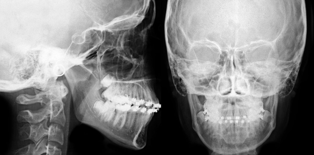 Téléradiographie du crâne Sousse